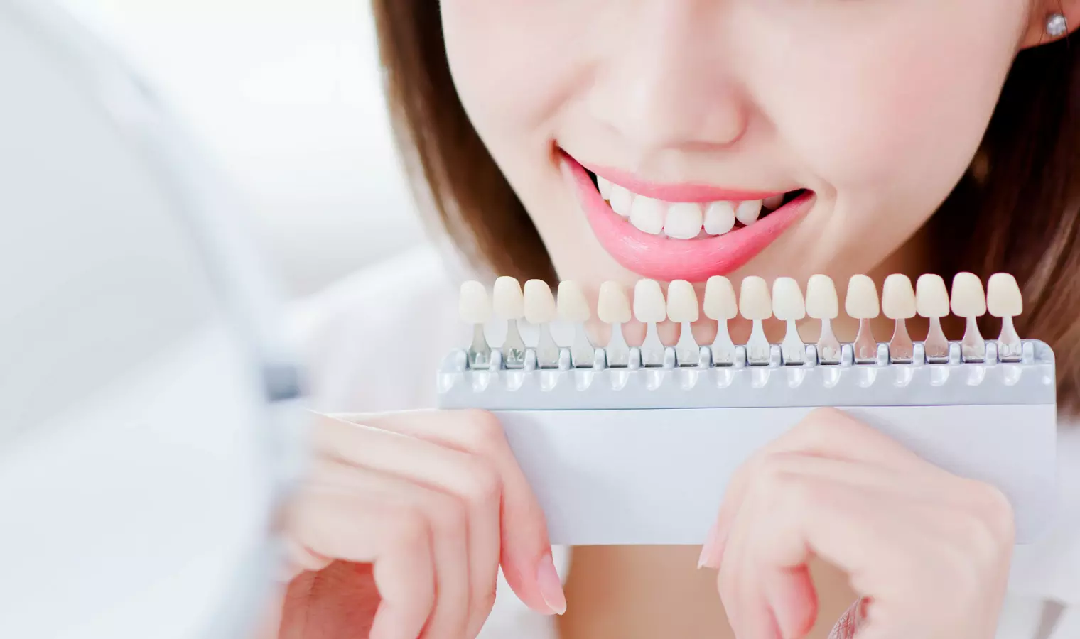 ホワイトニング