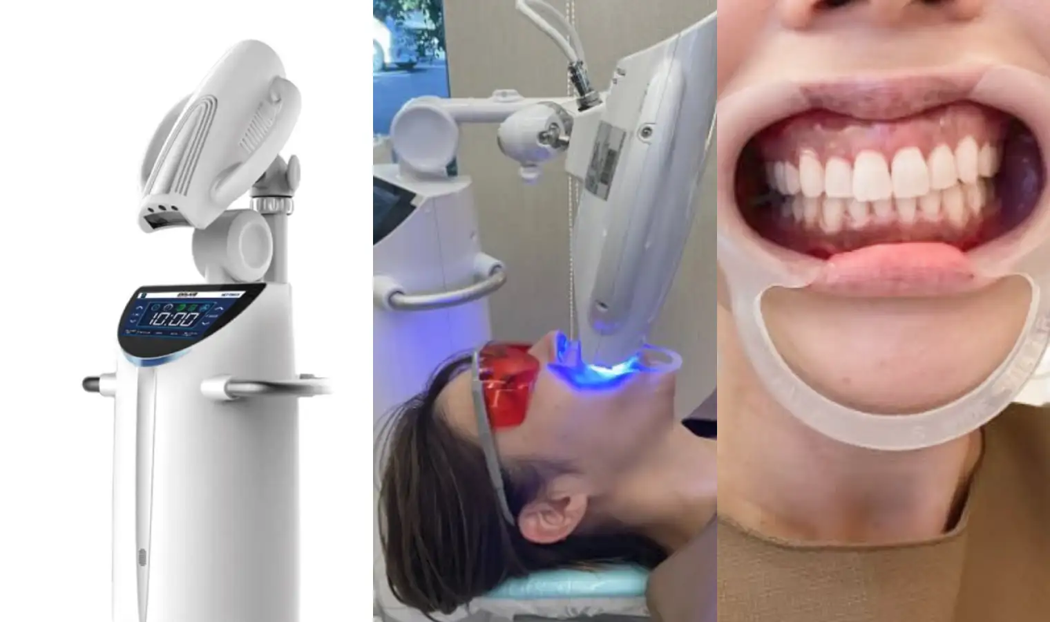 オフィスホワイトニング